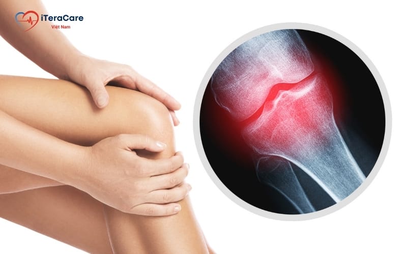 hỗ trợ vấn đề xương khớp