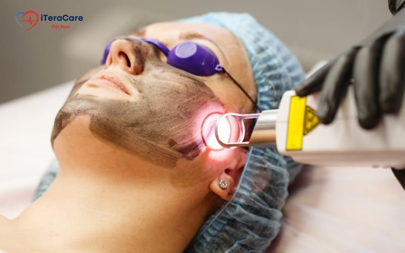 trị liệu bằng laser