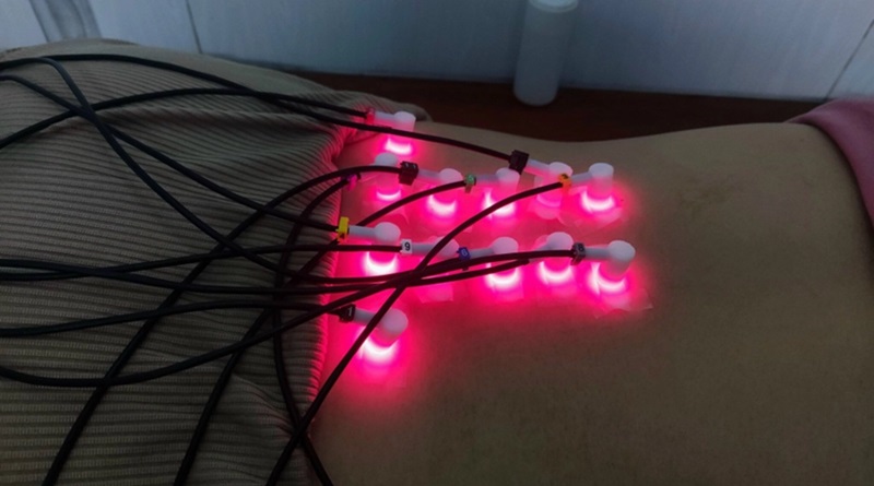 Máy Laser Châm Cứu Biolight