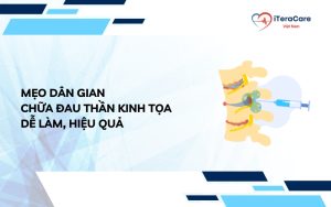 mẹo nhân gian chữa đau thần kinh tọa