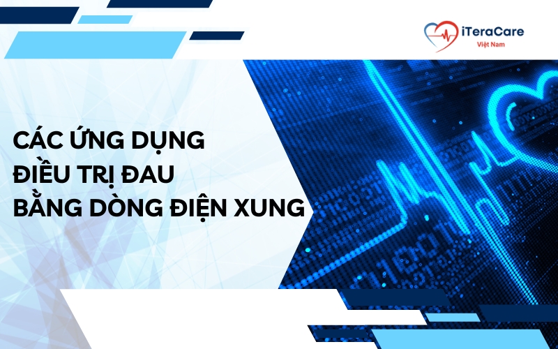 điều trị đau bằng dòng điện xung