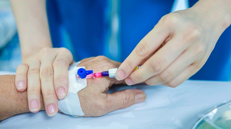 laser nội mạch là gì