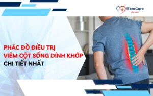 phác đồ điều trị viêm cột sống dính khớp
