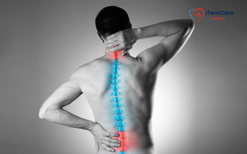 triệu chứng viêm cột sống dính khớp