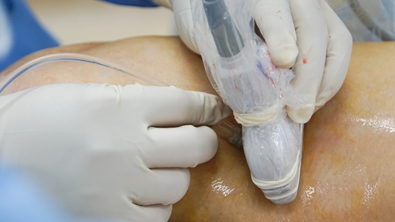 viêm hoặc nhiễm trùng